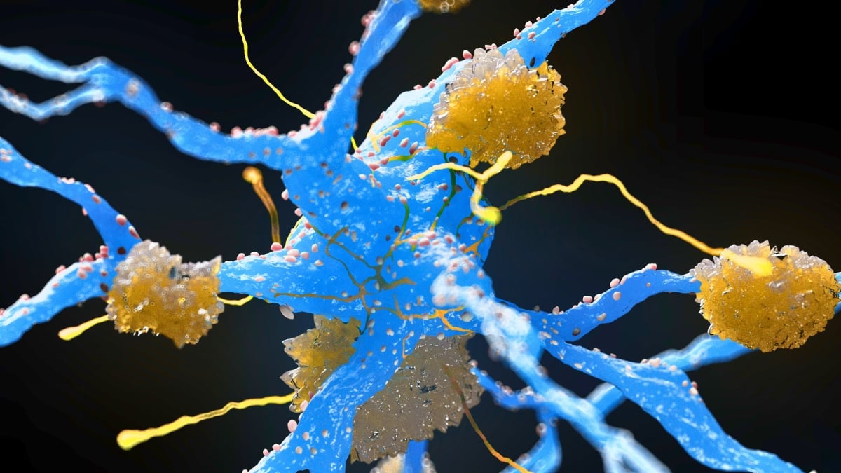 Netikėtas „Ozempic“ efektas: tyrėjai sako, kad lieknėjimo vaistai gali veikti Alzheimerio baltymus