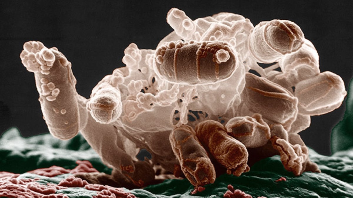 Mokslininkai įspėja: kai kurie antibiotikai gali dar labiau įplieskti uždegimą organizme