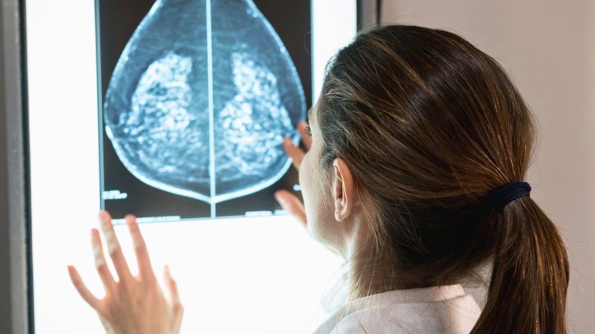 Mokslininkai atskleidė, kodėl krūties vėžio rizika su amžiumi šauna į viršų: lūžis per menopauzę