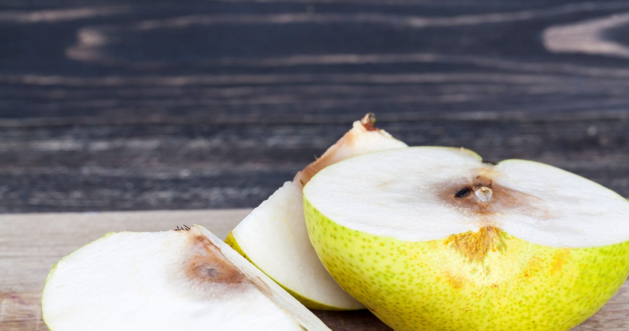 Ne bananas: Lietuvoje įprastas vaisius siejamas su geresne atmintimi ir mažesne insulto rizika