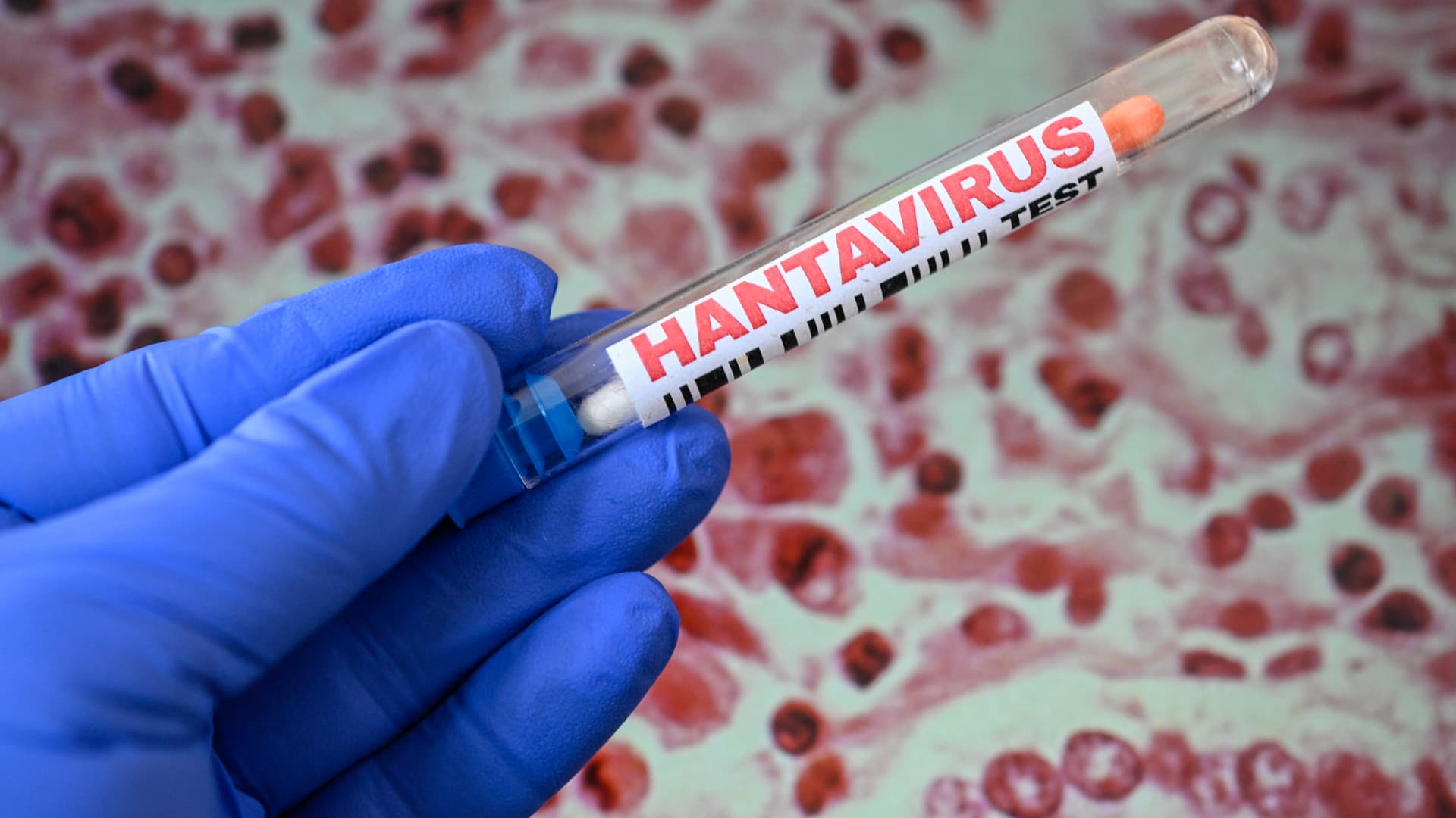 Hantaviruso protrūkis išjudino „Moderna“ ir kitų biotechnologijų akcijas: kas vyksta iš tiesų?