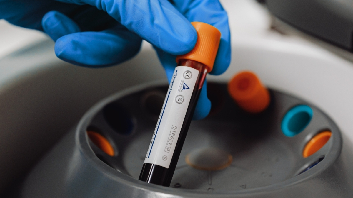 Šokiruojantis tyrimas: PFAS „amžinieji chemikalai“ aptikti beveik visų žmonių kraujyje