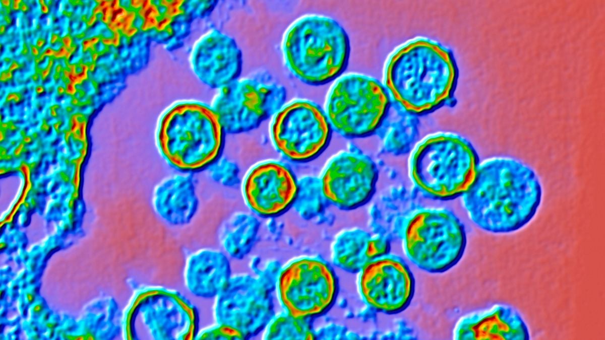 Mirtinas įtariamas hantaviruso protrūkis kruiziniame laive: 3 mirė, laivas izoliuotas