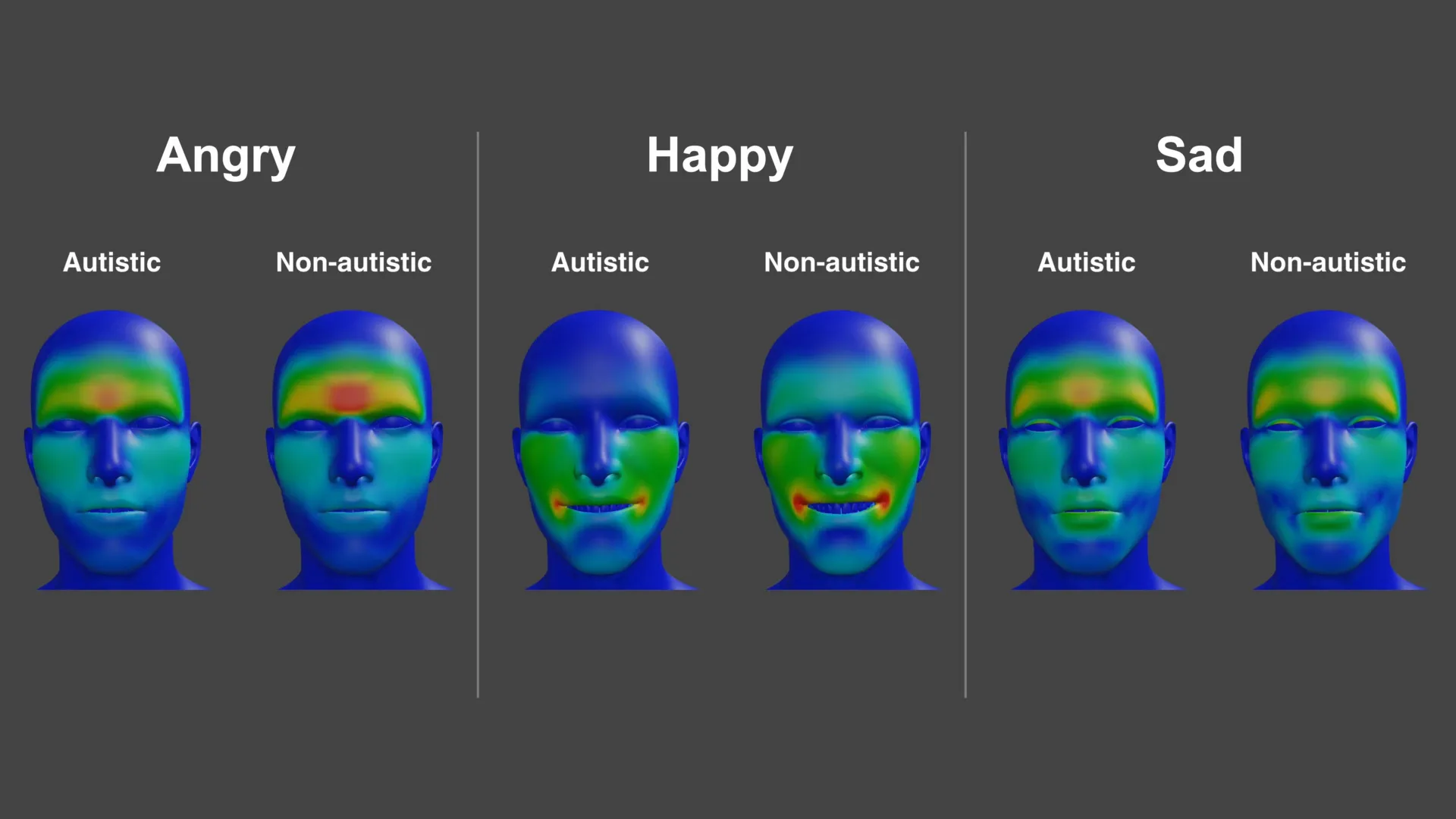 Autism facial expressions mapped in vast new dataset, offering clues to why emotions are often misread