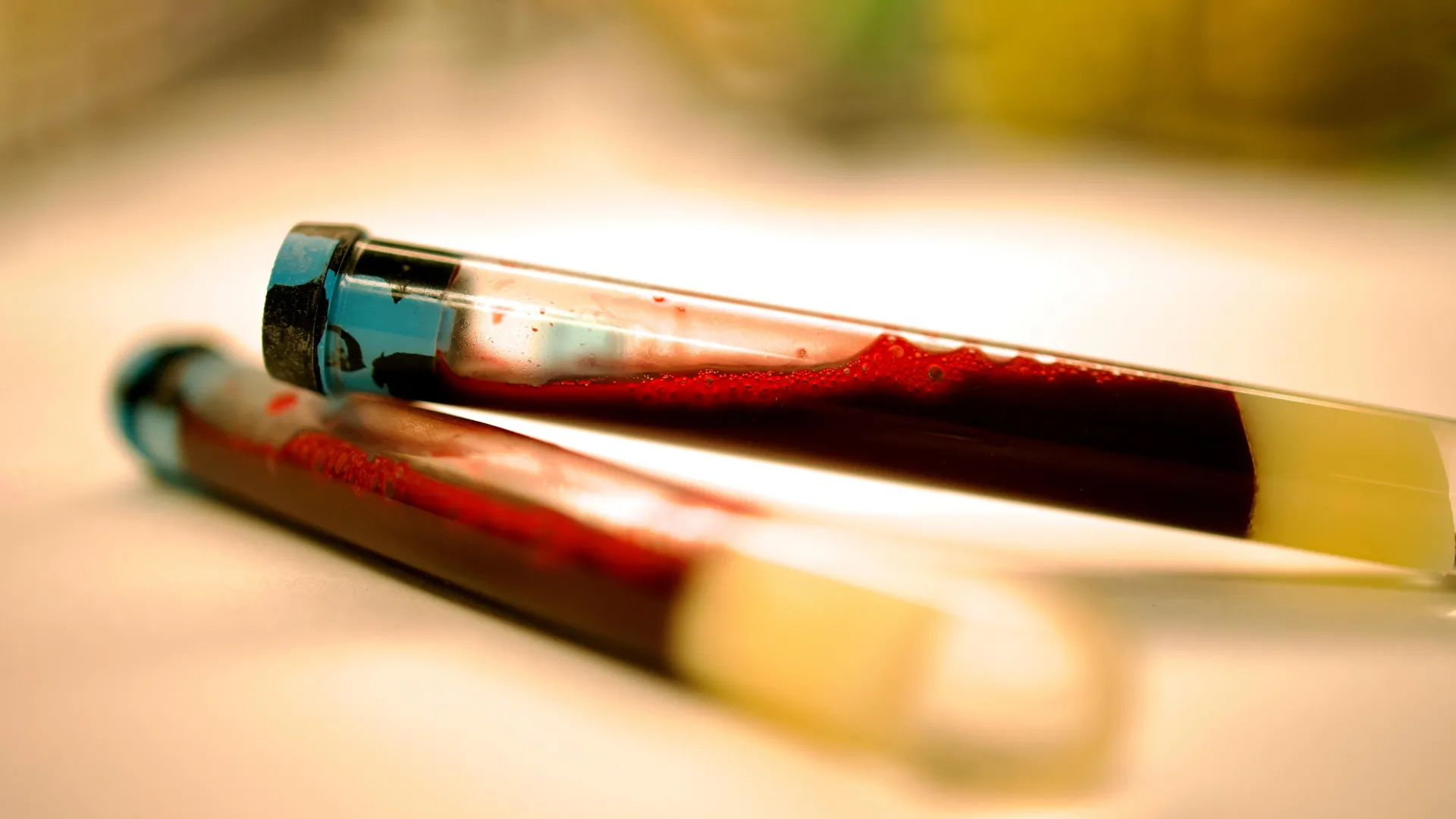Researchers move closer to an early Parkinson’s blood test, with a five-year timeline in sight