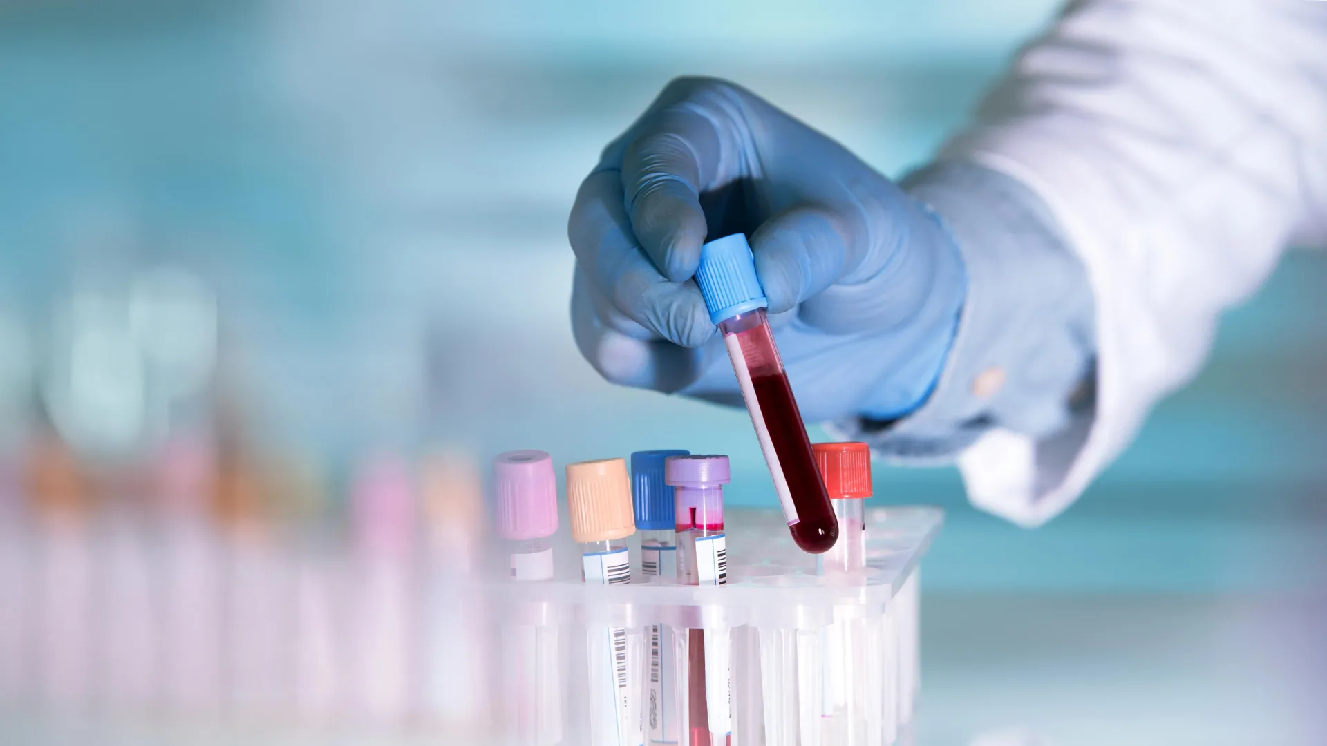 A simple blood test could spot depression risk early by tracking immune cell aging