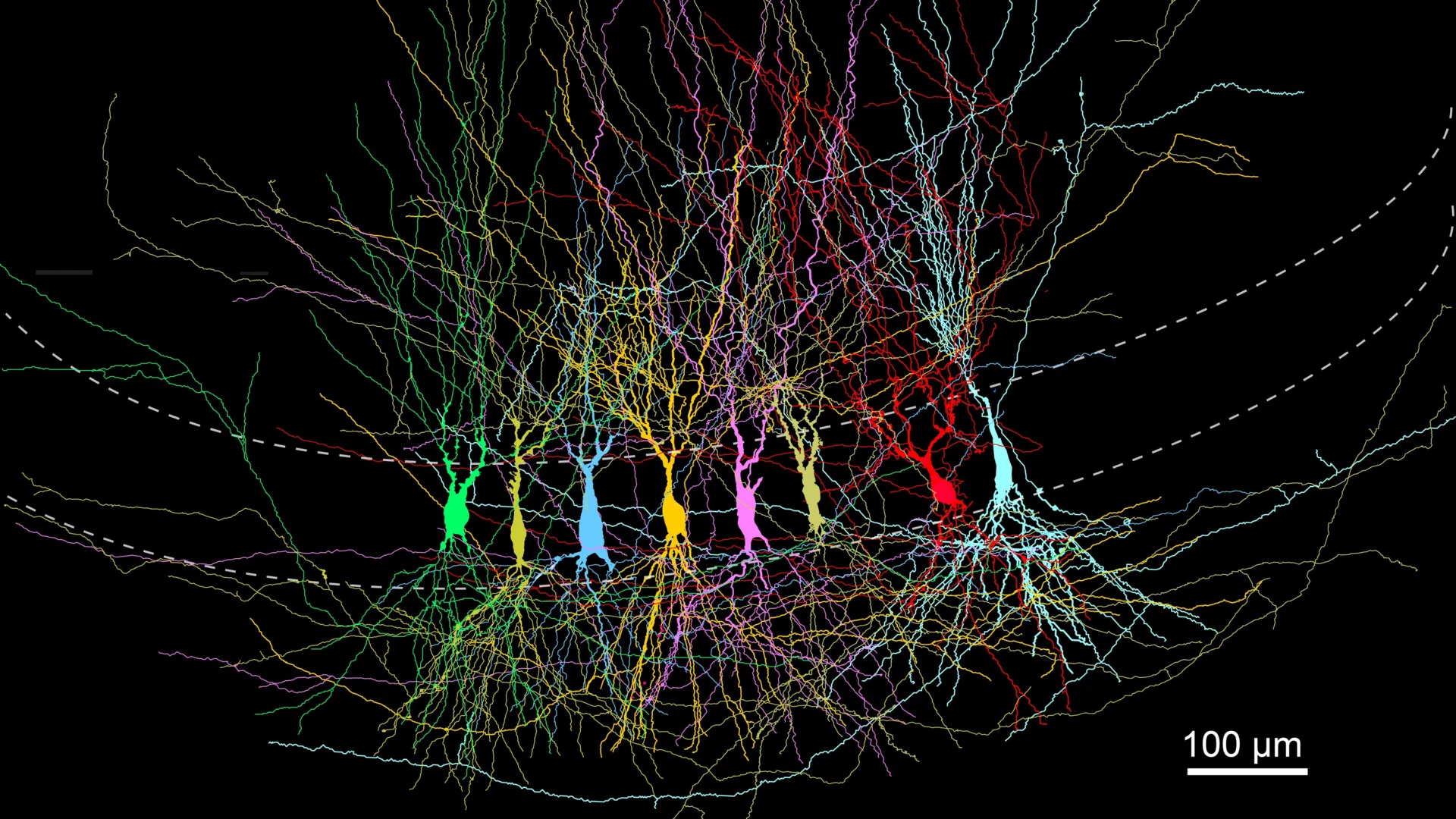 Study of the hippocampus suggests newborn brains start densely wired, then prune connections for sharper memory