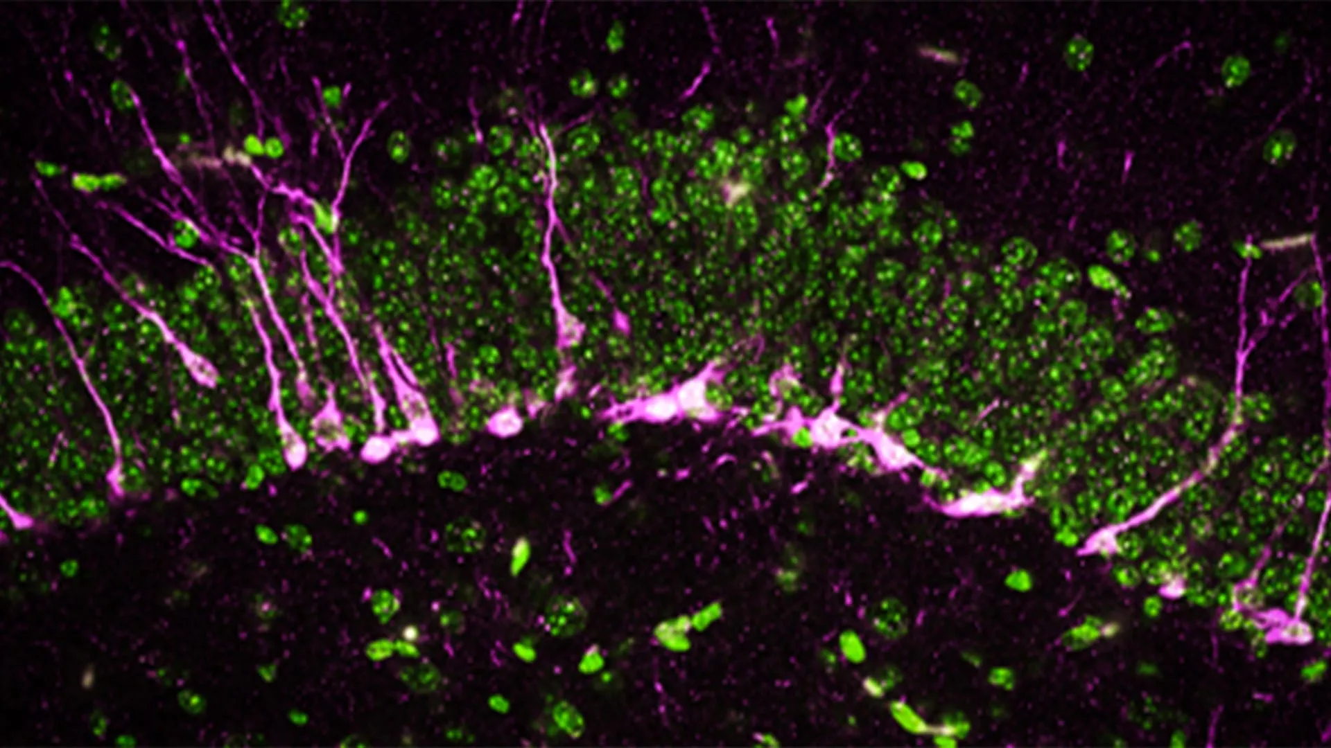 Johns Hopkins study spotlights hydrogen sulfide signaling as a potential new target in Alzheimer’s research