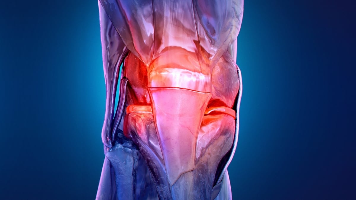 Naujas vilties būdas nuo osteoartrito: raumenys stimuliuojami elektra, bet yra svarbių ribų