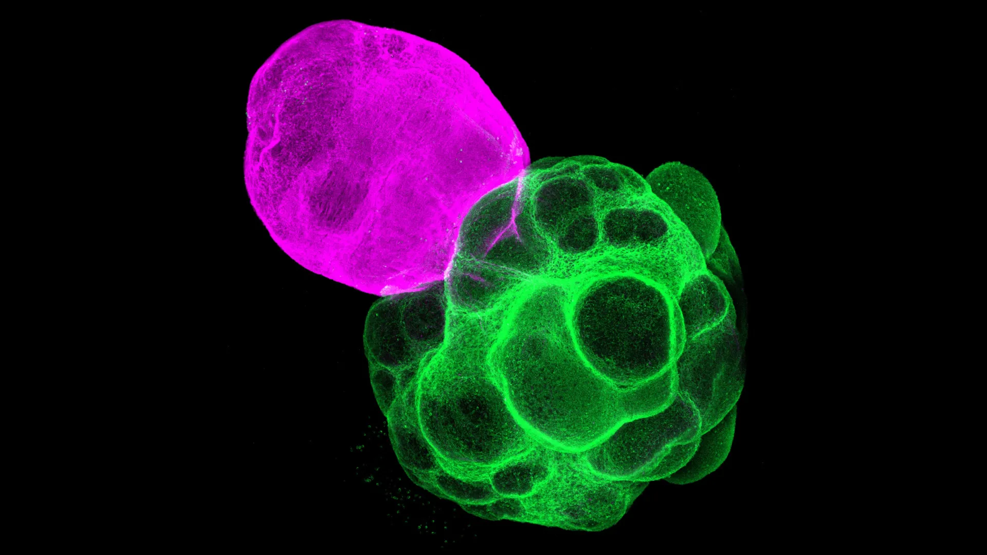 Japanese researchers grow thalamus-cortex brain circuits in lab assembloids, opening a new window on neural development